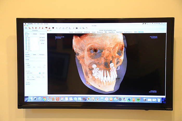 3D X-ray